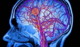 脑梗塞吃瓜尖,天然食疗新选择